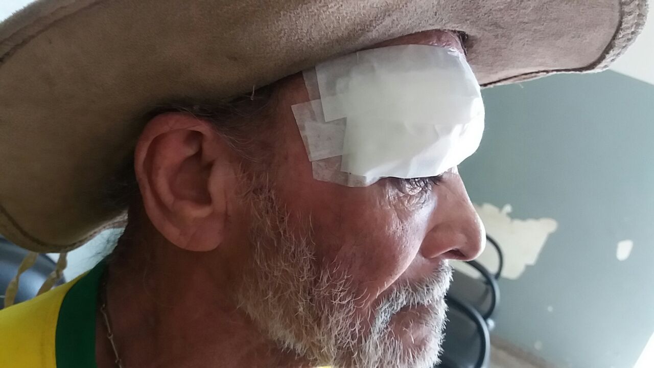 Senhor de 67 anos, residente na Vila Nova, foi golpeado com barra de ferro na madrugada desta sexta-feira, 27 (Foto: Jornal da Franca)